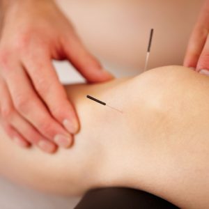 acupuncture in knee